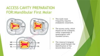 Endodontic Access Cavity Preparation.1.pptx