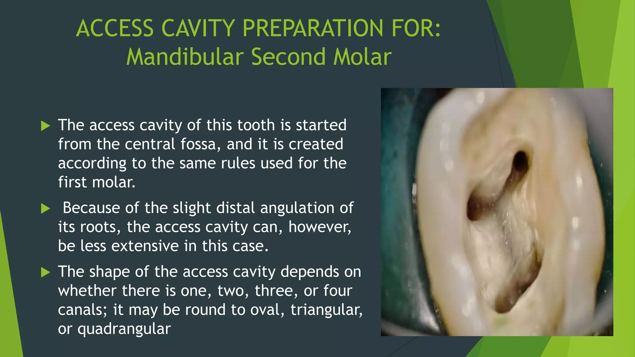 Endodontic Access Cavity Preparation PPTX