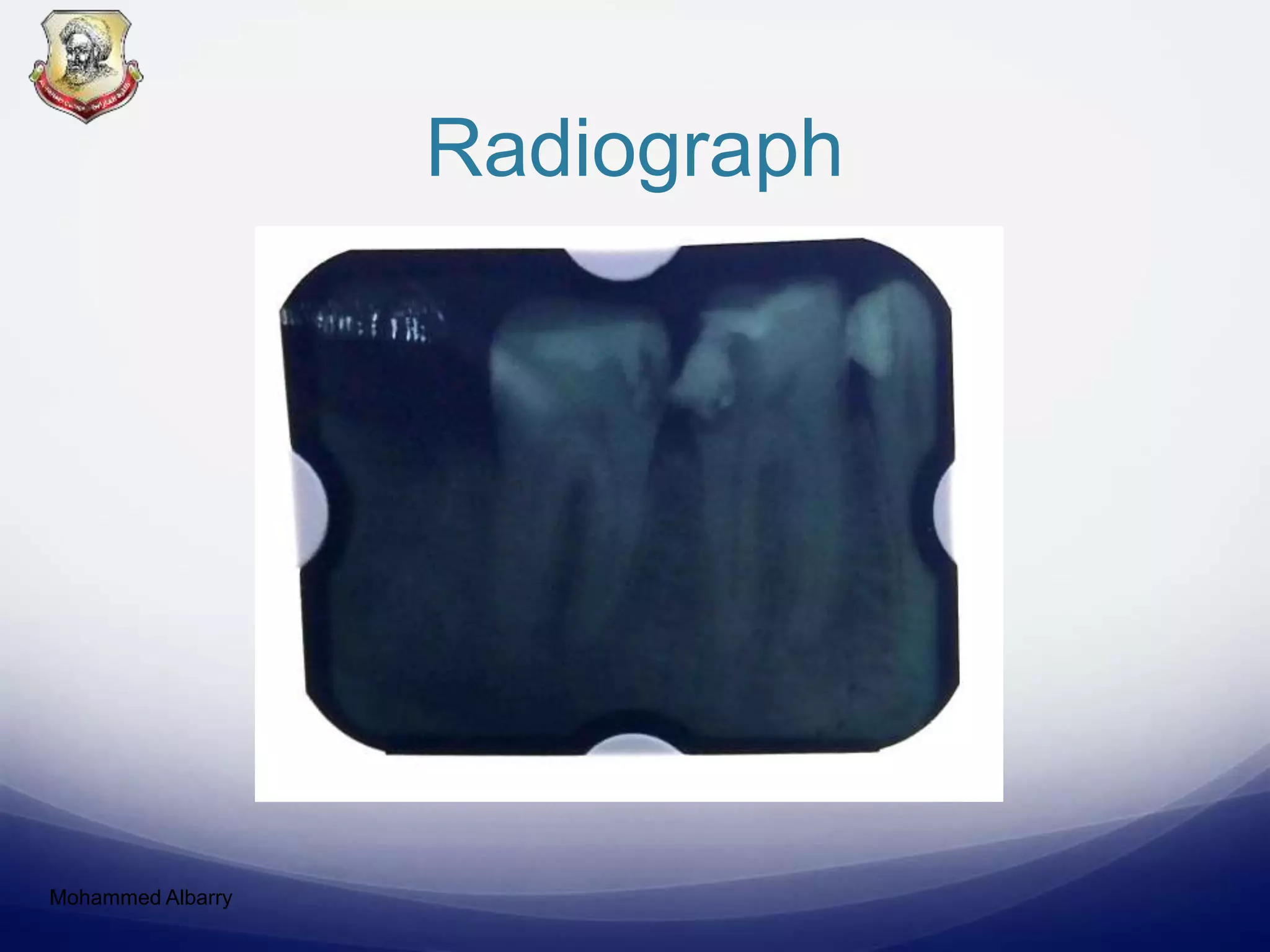 Radiograph
Mohammed Albarry
 