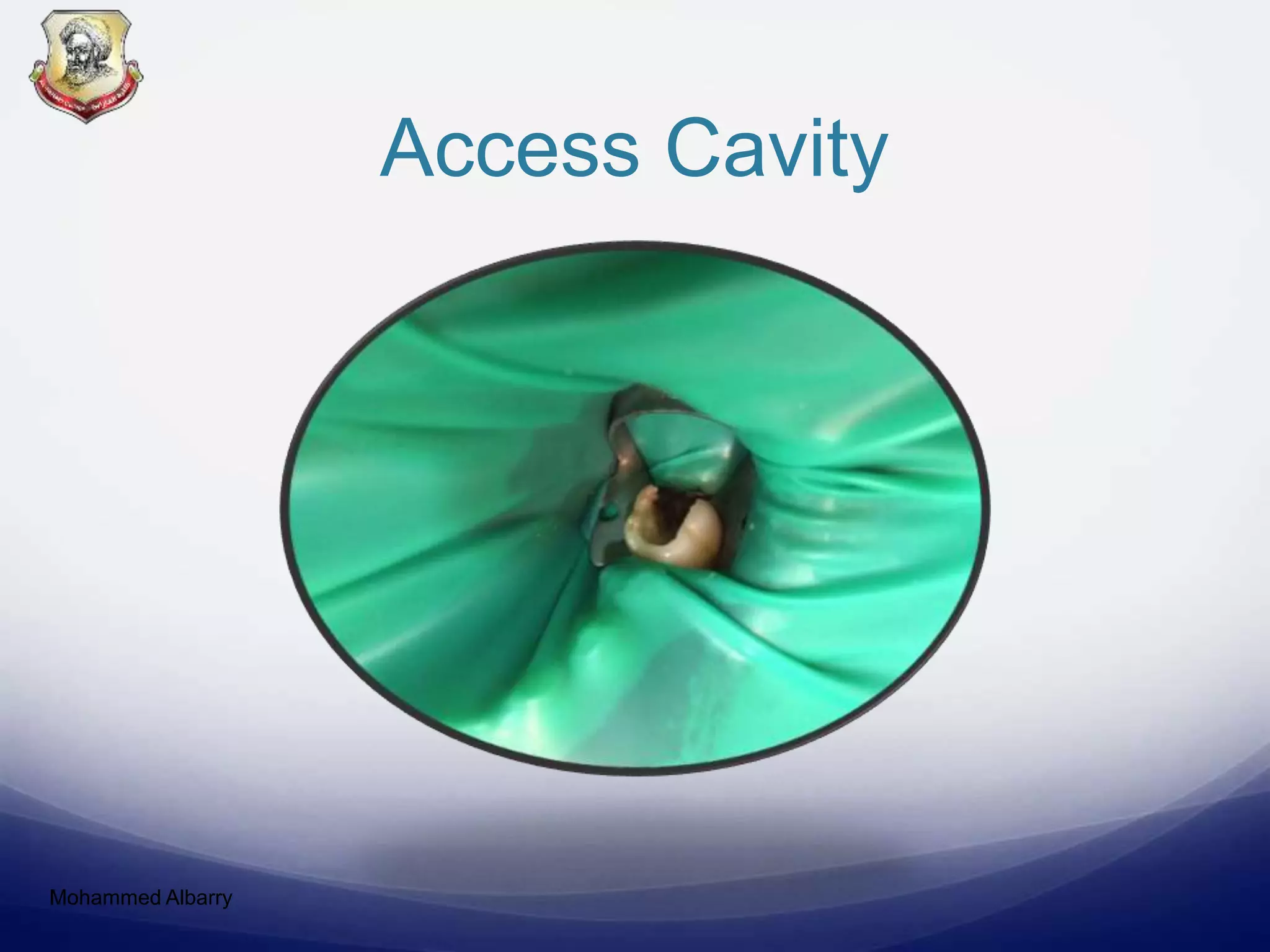 Access Cavity
Mohammed Albarry
 