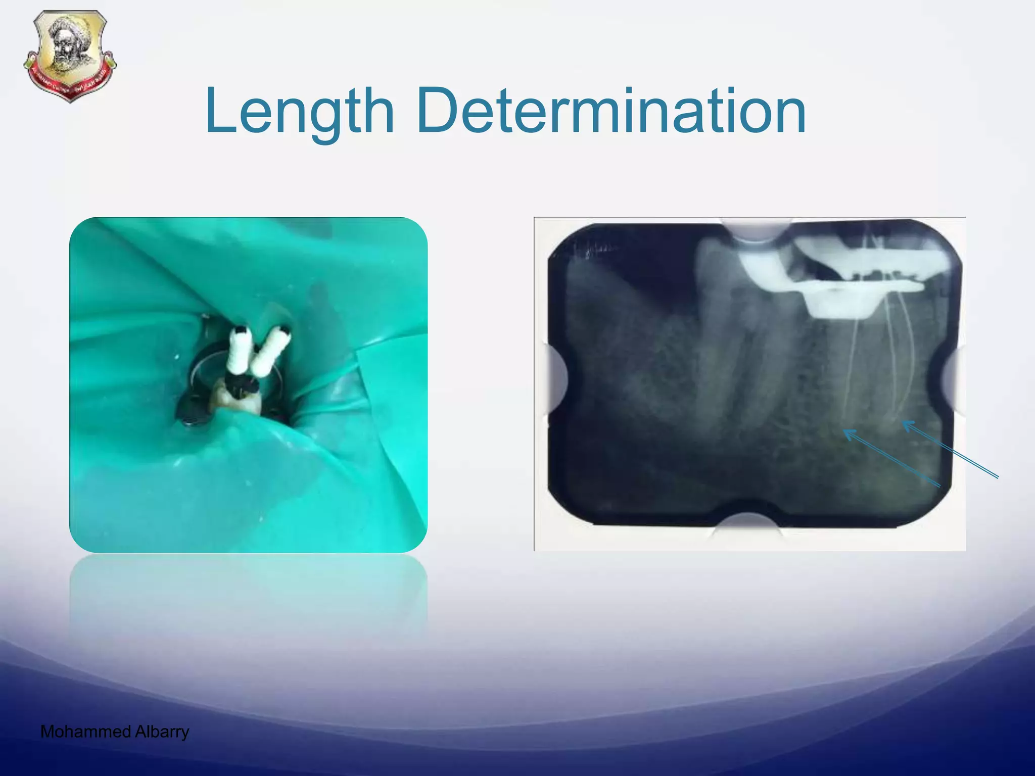 Length Determination
Mohammed Albarry
 