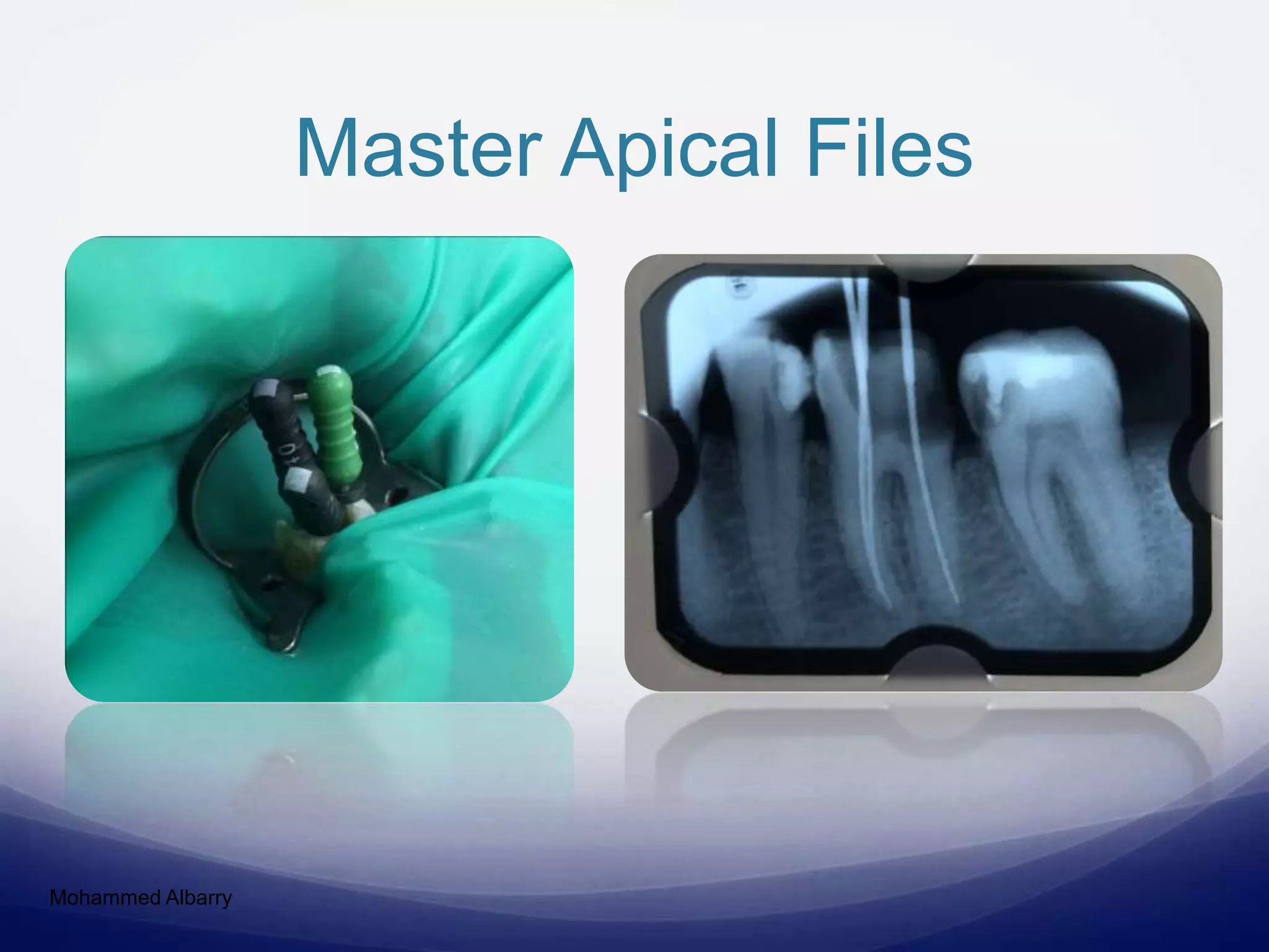 Master Apical Files
Mohammed Albarry
 