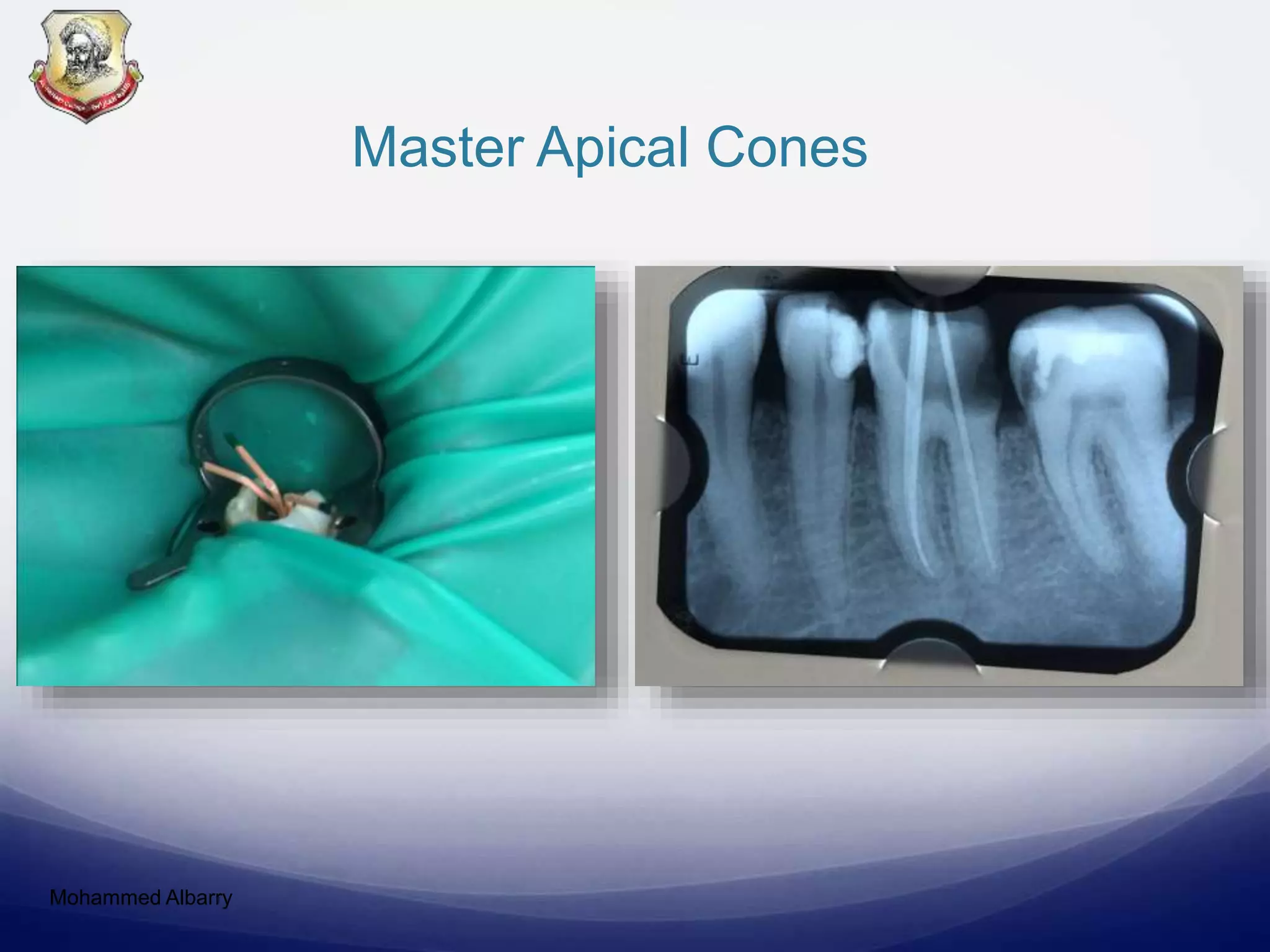 Master Apical Cones
Mohammed Albarry
 