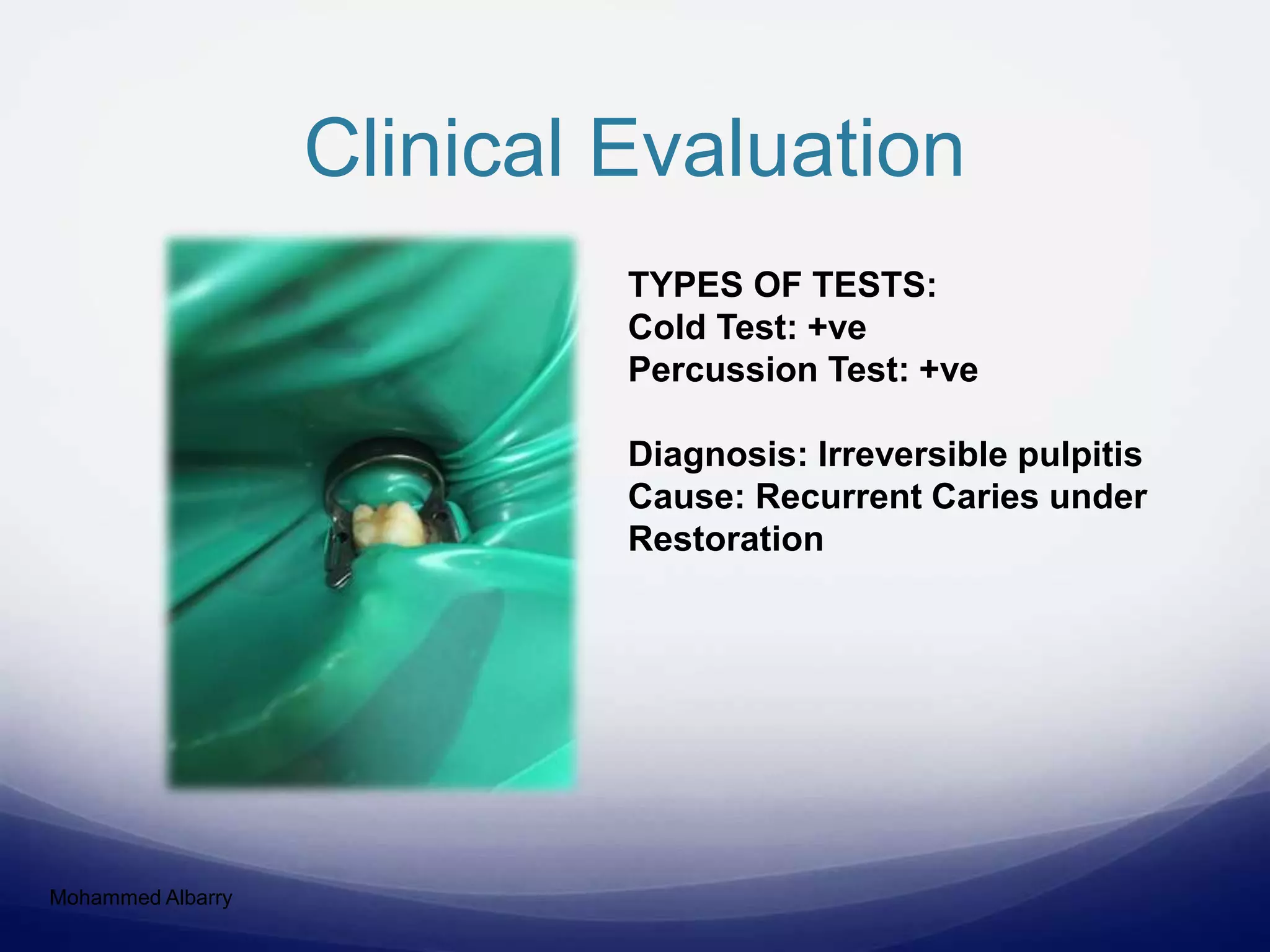 Clinical Evaluation
Mohammed Albarry
TYPES OF TESTS:
Cold Test: +ve
Percussion Test: +ve
Diagnosis: Irreversible pulpitis
Cause: Recurrent Caries under
Restoration
 