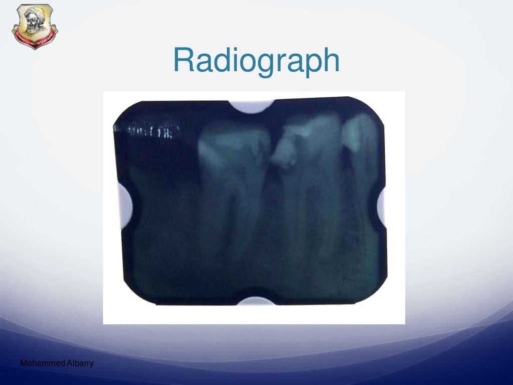 Endodontics Case Presentation