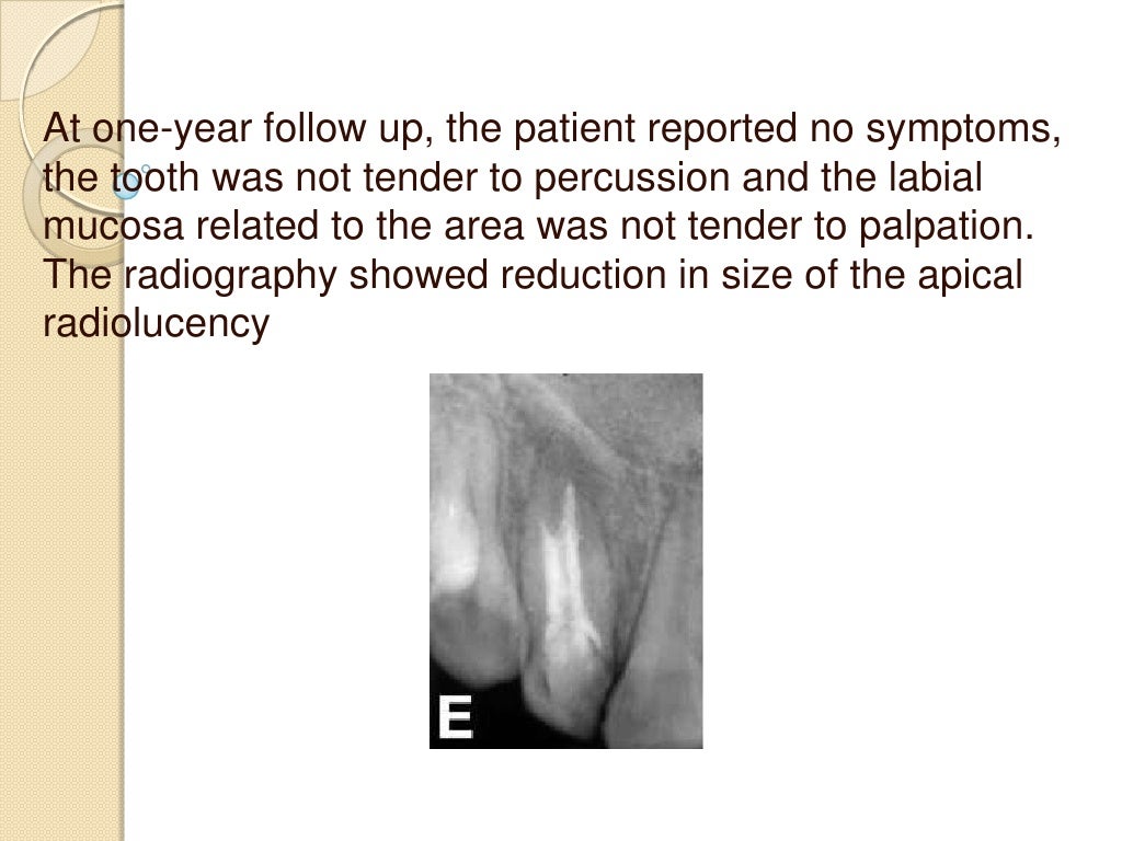 Endodontic case reports a review