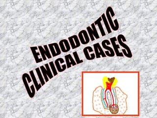 ENDODONTIC  CLINICAL CASES 