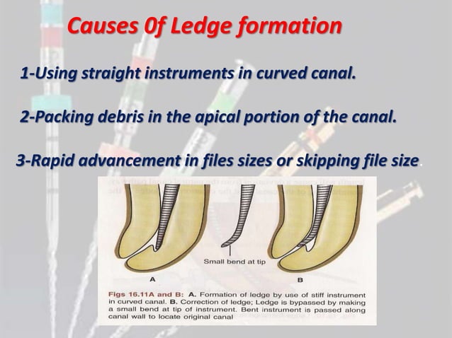 Endodontic Complications