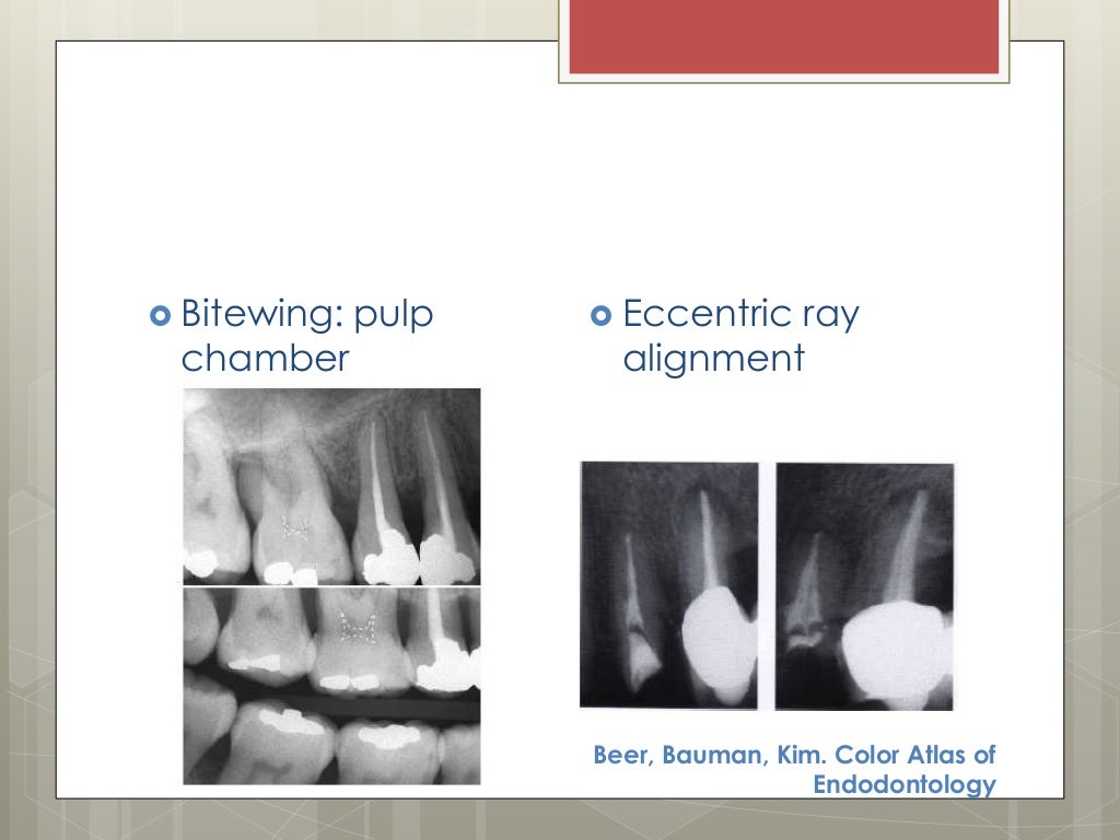Endodontic diagnosis