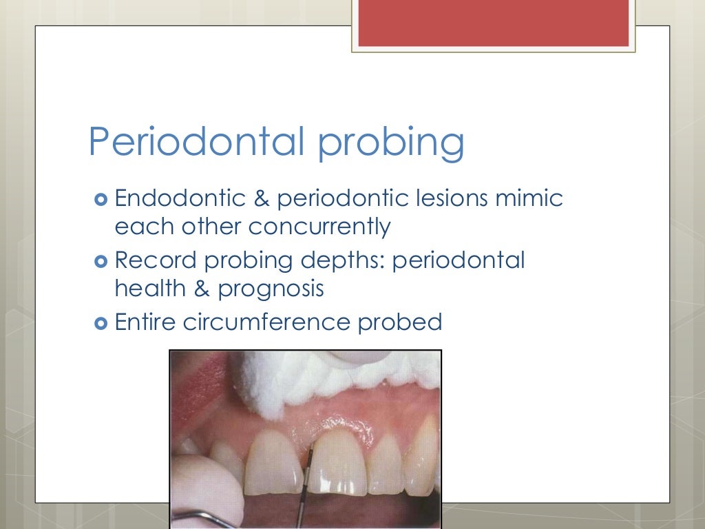 Endodontic diagnosis