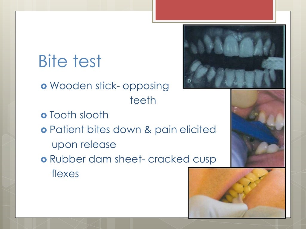 Endodontic diagnosis