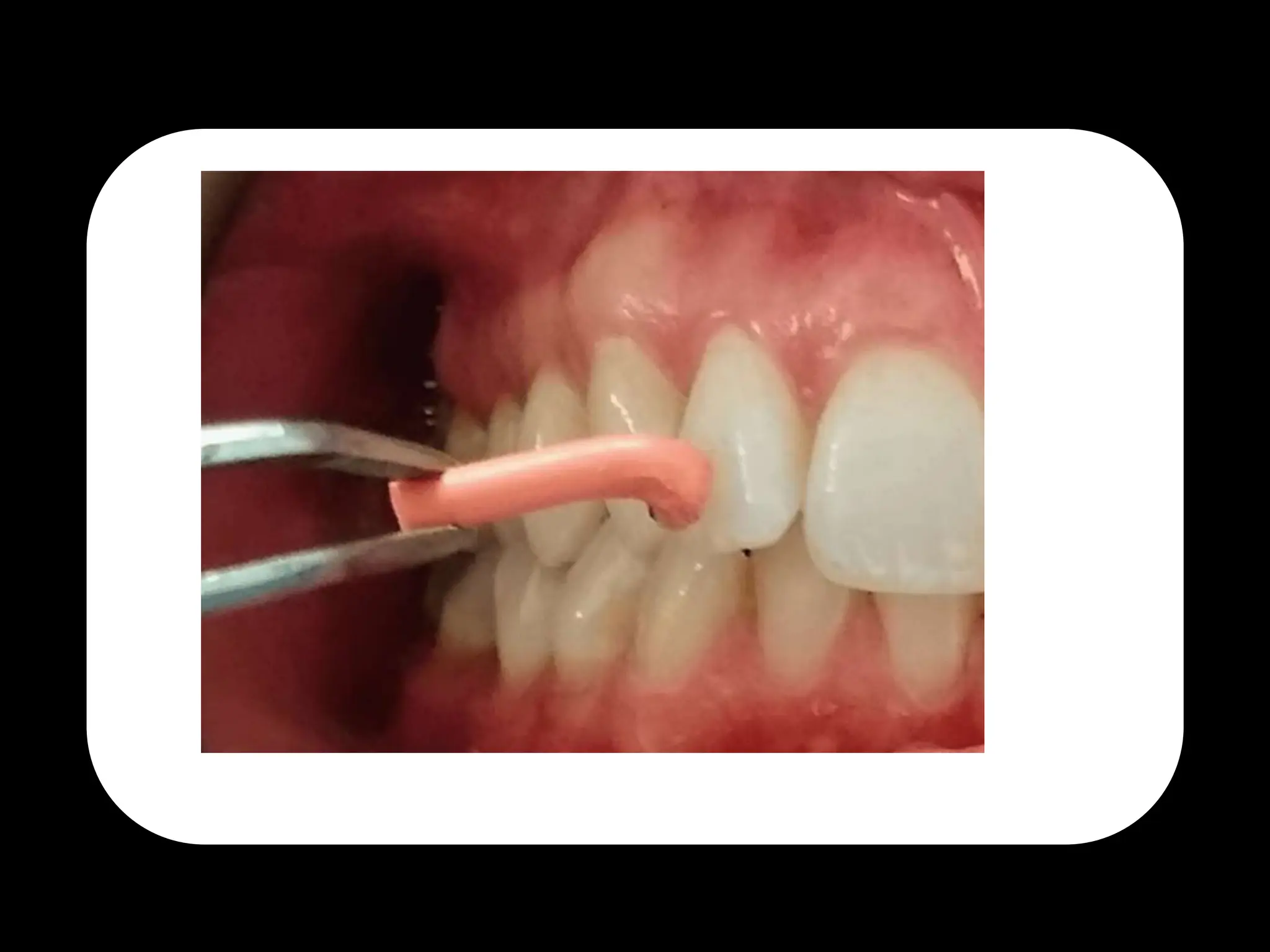 Endodontic Diagnosis. first part in diagnosispptx PPTX