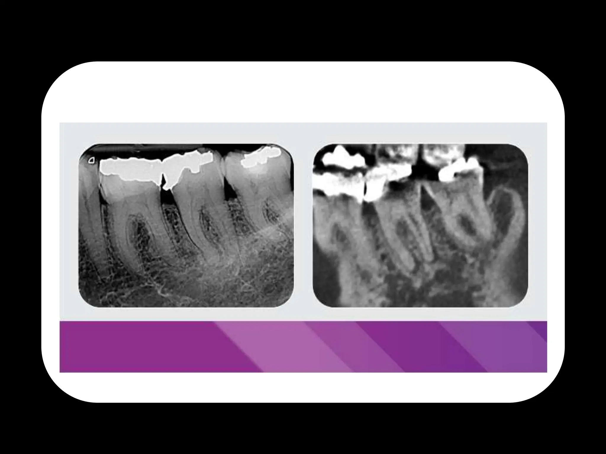 Endodontic Diagnosis. first part in diagnosispptx PPTX