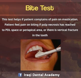 Endodontic Diagnosis: Pulp Vitality Tests