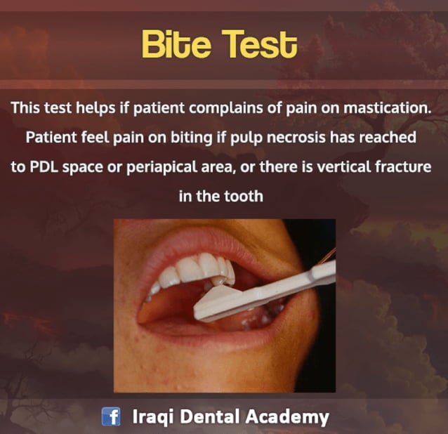 Endodontic Diagnosis Pulp Vitality Tests