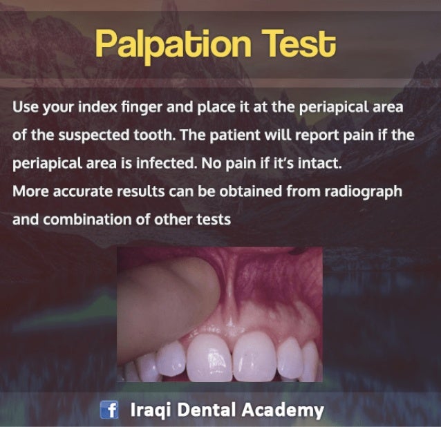 Endodontic Diagnosis Pulp Vitality Tests