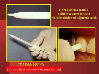 CO2 Stick (-50º C) 
It transforms from a 
solid to a gaseous state 
No stimulation of adjacent teeth 
(An excellent method of thermal testing) 
 