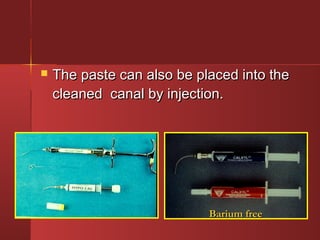  The paste can aallssoo bbee ppllaacceedd iinnttoo tthhee 
cclleeaanneedd ccaannaall bbyy iinnjjeeccttiioonn.. 
BBaarriiuumm ffrreeee 
 