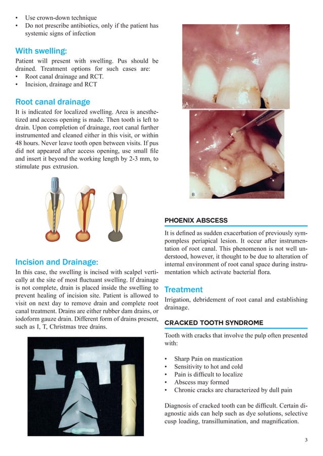 Endodontic Emergencies Summary for Students