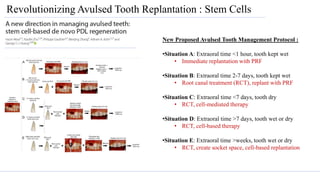 Endodontic Emergencies | PPTX