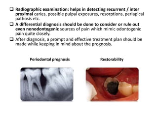  Radiographic examination: helps in detecting recurrent / inter
proximal caries, possible pulpal exposures, resorptions, periapical
pathosis etc.
 A differential diagnosis should be done to consider or rule out
even nonodontogenic sources of pain which mimic odontogenic
pain quite closely.
 After diagnosis, a prompt and effective treatment plan should be
made while keeping in mind about the prognosis.
Periodontal prognosis Restorability
 