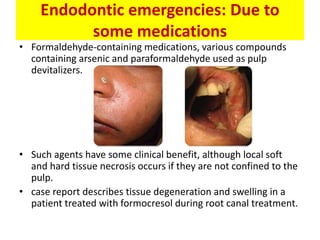 Endodontic emergencies: Due to
some medications
• Formaldehyde-containing medications, various compounds
containing arsenic and paraformaldehyde used as pulp
devitalizers.
• Such agents have some clinical benefit, although local soft
and hard tissue necrosis occurs if they are not confined to the
pulp.
• case report describes tissue degeneration and swelling in a
patient treated with formocresol during root canal treatment.
 