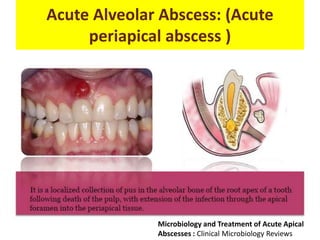 Acute Alveolar Abscess: (Acute
periapical abscess )
Microbiology and Treatment of Acute Apical
Abscesses : Clinical Microbiology Reviews
 