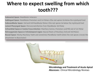 Where to expect swelling from which
tooth???
Microbiology and Treatment of Acute Apical
Abscesses : Clinical Microbiology Reviews
 