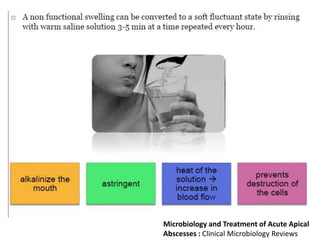 Microbiology and Treatment of Acute Apical
Abscesses : Clinical Microbiology Reviews
 