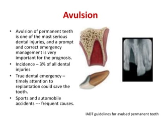 Avulsion
• Avulsion of permanent teeth
is one of the most serious
dental injuries, and a prompt
and correct emergency
management is very
important for the prognosis.
• Incidence – 3% of all dental
injuries
• True dental emergency –
timely attention to
replantation could save the
tooth.
• Sports and automobile
accidents --- frequent causes.
IADT guidelines for avulsed permanent teeth
 