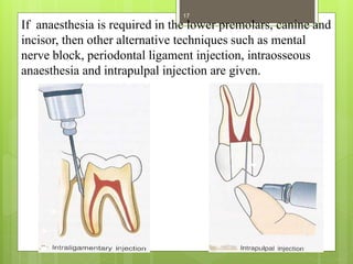 If anaesthesia is required in the lower premolars, canine and
incisor, then other alternative techniques such as mental
nerve block, periodontal ligament injection, intraosseous
anaesthesia and intrapulpal injection are given.
17
 