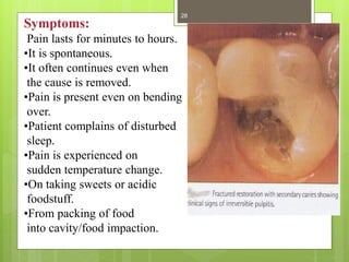 Symptoms:
Pain lasts for minutes to hours.
•It is spontaneous.
•It often continues even when
the cause is removed.
•Pain is present even on bending
over.
•Patient complains of disturbed
sleep.
•Pain is experienced on
sudden temperature change.
•On taking sweets or acidic
foodstuff.
•From packing of food
into cavity/food impaction.
28
 