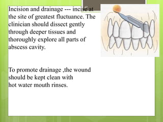 Incision and drainage --- incise at
the site of greatest fluctuance. The
clinician should dissect gently
through deeper tissues and
thoroughly explore all parts of
abscess cavity.
To promote drainage ,the wound
should be kept clean with
hot water mouth rinses.
47
 