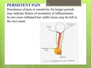 PERSISTENT PAIN
Persistence of pain or sensitivity for longer periods
may indicate failure of resolution of inflammation.
In rare cases inflamed but viable tissue may be left in
the root canal.
59
 