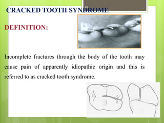 CRACKED TOOTH SYNDROME
DEFINITION:
Incomplete fractures through the body of the tooth may
cause pain of apparently idiopathic origin and this is
referred to as cracked tooth syndrome.
61
 