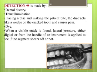 DETECTION  is made by:
•Dental history.
•Transillumination.
•Placing a disc and making the patient bite, the disc acts
like a wedge on the cracked tooth and causes pain.
•Dye.
•When a visible crack is found, lateral pressure, either
digital or from the handle of an instrument is applied to
see if the segment shears off or not.
63
 