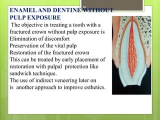 ENAMELAND DENTINE WITHOUT
PULP EXPOSURE
The objective in treating a tooth with a
fractured crown without pulp exposure is
Elimination of discomfort
Preservation of the vital pulp
Restoration of the fractured crown
This can be treated by early placement of
restoration with pulpal protection like
sandwich technique.
The use of indirect veneering later on
is another approach to improve esthetics.
68
 
