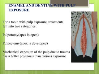 ENAMELAND DENTINE WITH PULP
EXPOSURE
For a tooth with pulp exposure, treatments
fall into two categories :
Pulpotomy(apex is open)
Pulpectomy(apex is developed)
Mechanical exposure of the pulp due to trauma
has a better prognosis than carious exposure.
69
 
