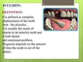 AVULSION:
DEFINITION:
It is defined as complete
displacement of the tooth
from the alveolus .
It is usually the result of
trauma to an anterior teeth and
is both dental
and emotional problem.
Prognosis depends on the amount
of time the tooth is out of the
socket.
78
 