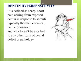 DENTIN HYPERSENSITIVITY
It is defined as sharp, short
pain arising from exposed
dentin in response to stimuli
typically th...