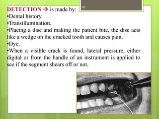 DETECTION  is made by:
•Dental history.
•Transillumination.
•Placing a disc and making the patient bite, the disc acts
li...
