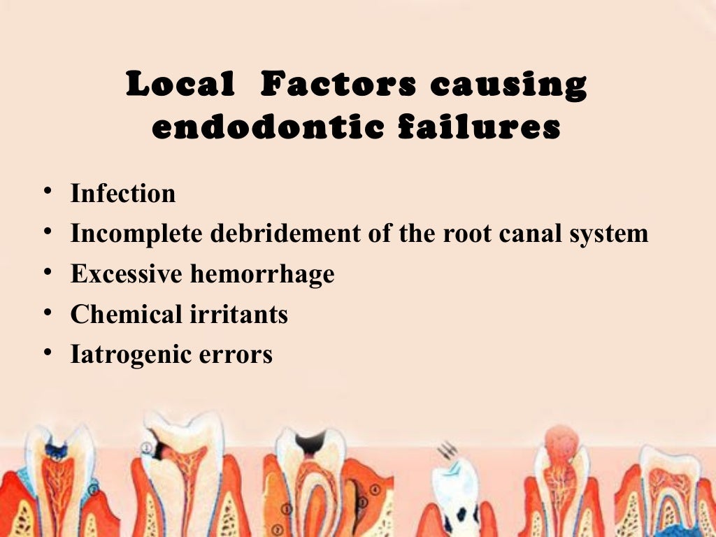 Endodontic failures