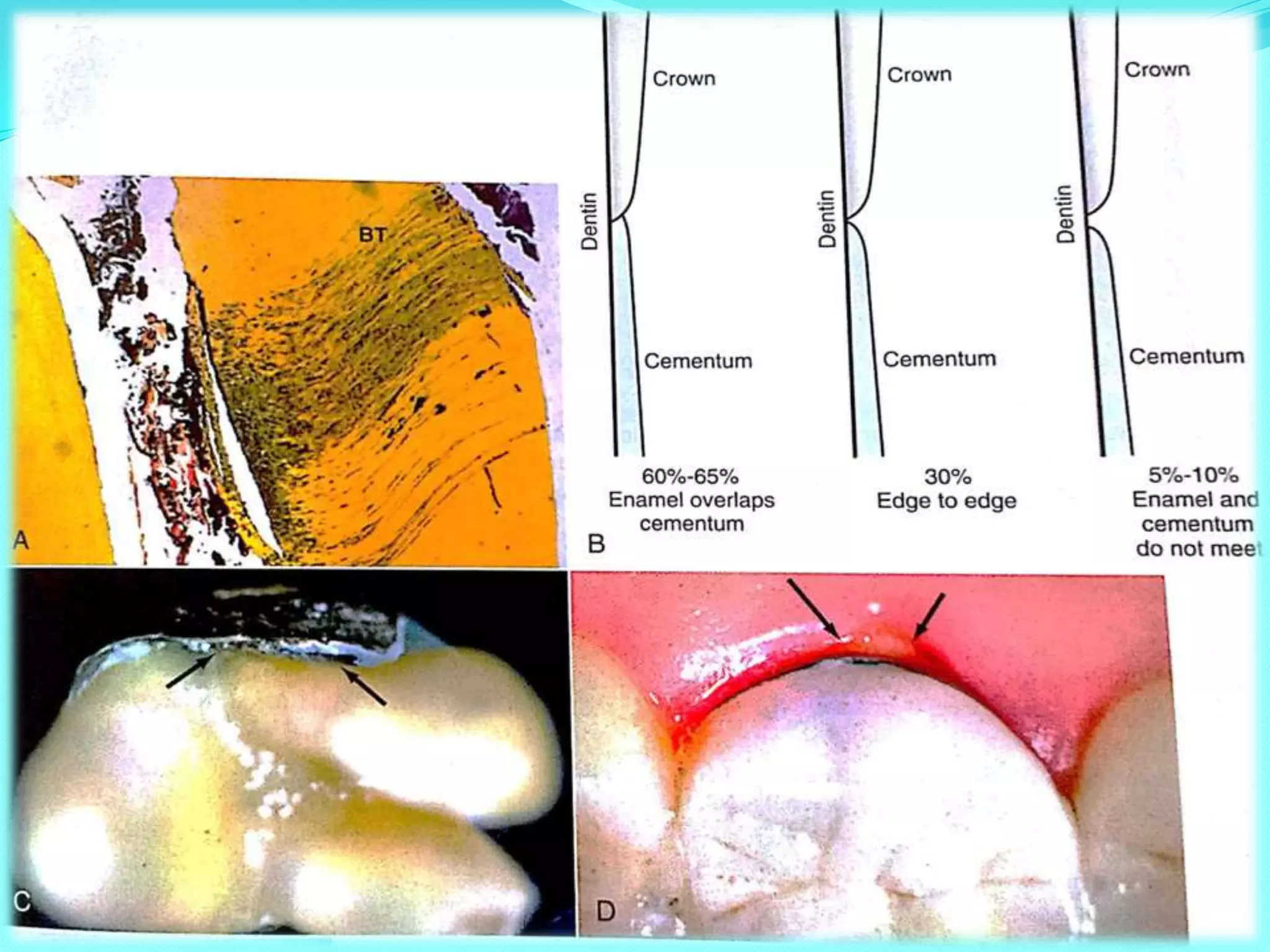 Endodontic Failures and Mishaps | PPTX
