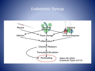 Endodontic flareup
 
