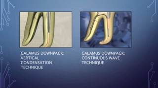 CALAMUS DOWNPACK:
VERTICAL
CONDENSATION
TECHNIQUE
CALAMUS DOWNPACK:
CONTINUOUS WAVE
TECHNIQUE
 