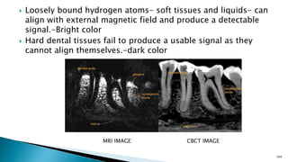  Loosely bound hydrogen atoms- soft tissues and liquids- can
align with external magnetic field and produce a detectable
signal.-Bright color
 Hard dental tissues fail to produce a usable signal as they
cannot align themselves.-dark color
104
MRI IMAGE CBCT IMAGE
 