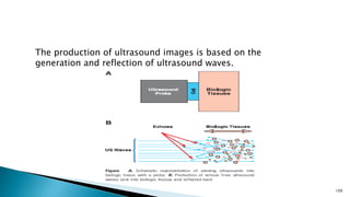 109
The production of ultrasound images is based on the
generation and reflection of ultrasound waves.
 