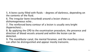 5. A bone cavity filled with fluids - degrees of darkness, depending on
the contents of the fluid.
6. The irregular bone (resorbed) around a lesion shows a
dishomogeneous echo .
7. The reinforced bony contour of a lesion is usually very bright
(hyperechoic) .
8. By applying the CPD to the examination procedure, the presence and
direction of blood vessels around and within the lesion can be
detected.
9. The mandibular canal, the mental foramen, and the maxillary sinus
can often be distinguished and appear mostly transonic.
111
 