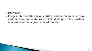  Drawback-
 Images interpretation is very critical and needs an expert eye,
and there are not landmarks to help distinguish the position
of a lesion within a given area of mouth.
114
 