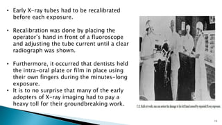 13
• Early X-ray tubes had to be recalibrated
before each exposure.
• Recalibration was done by placing the
operator’s hand in front of a fluoroscope
and adjusting the tube current until a clear
radiograph was shown.
• Furthermore, it occurred that dentists held
the intra-oral plate or film in place using
their own fingers during the minutes-long
exposure.
• It is to no surprise that many of the early
adopters of X-ray imaging had to pay a
heavy toll for their groundbreaking work.
 